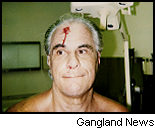 The day gotti got beat